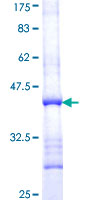 ab160732 on a 12.5% SDS-PAGE stained with Coomassie Blue.
