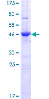 ab165835 on a 12.5% SDS-PAGE stained with Coomassie Blue.
