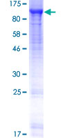 ab157884 on a 12.5% SDS-PAGE stained with Coomassie Blue.