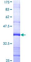 ab159185 on a 12.5% SDS-PAGE stained with Coomassie Blue.