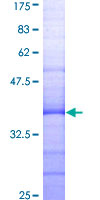 ab159187 on a 12.5% SDS-PAGE stained with Coomassie Blue.