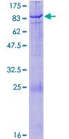 ab159188 on a 12.5% SDS-PAGE stained with Coomassie Blue.