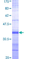 ab159189 on a 12.5% SDS-PAGE stained with Coomassie Blue.
