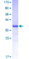 ab157902 on a 12.5% SDS-PAGE stained with Coomassie Blue.