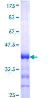 ab153609 on a 12.5% SDS-PAGE stained with Coomassie Blue.