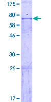 ab153331 on a 12.5% SDS-PAGE stained with Coomassie Blue.