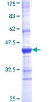 ab158266 on a 12.5% SDS-PAGE stained with Coomassie Blue.