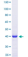 ab164446 on a 12.5% SDS-PAGE stained with Coomassie Blue.