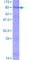 ab163357 on a 12.5% SDS-PAGE stained with Coomassie Blue.