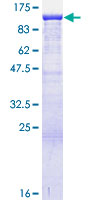 ab161887 on a 12.5% SDS-PAGE stained with Coomassie Blue.