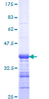 ab161888 on a 12.5% SDS-PAGE stained with Coomassie Blue.