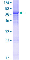 ab164535 on a 12.5% SDS-PAGE stained with Coomassie Blue.