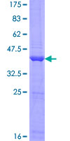 ab166350 on a 12.5% SDS-PAGE stained with Coomassie Blue.
