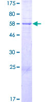 ab165180 on a 12.5% SDS-PAGE stained with Coomassie Blue.