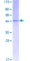 ab157890 on a 12.5% SDS-PAGE stained with Coomassie Blue.