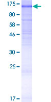 ab153622 on a 12.5% SDS-PAGE stained with Coomassie Blue.