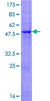 ab157920 on a 12.5% SDS-PAGE stained with Coomassie Blue.