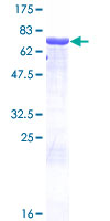 ab162598 on a 12.5% SDS-PAGE stained with Coomassie Blue.