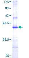 ab162599 on a 12.5% SDS-PAGE stained with Coomassie Blue.