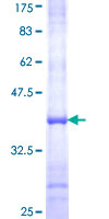 ab157895 on a 12.5% SDS-PAGE stained with Coomassie Blue.
