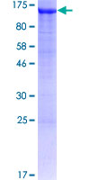 ab157866 on a 12.5% SDS-PAGE stained with Coomassie Blue.