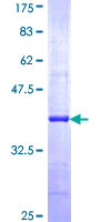 ab160256 on a 12.5% SDS-PAGE stained with Coomassie Blue.
