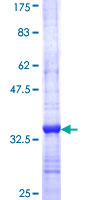 ab160257 on a 12.5% SDS-PAGE stained with Coomassie Blue.