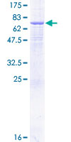 ab160786 on a 12.5% SDS-PAGE stained with Coomassie Blue.