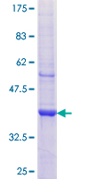 ab160787 on a 12.5% SDS-PAGE stained with Coomassie Blue.