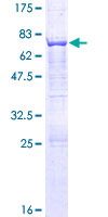 ab162048 on a 12.5% SDS-PAGE stained with Coomassie Blue.