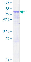 ab161211 on a 12.5% SDS-PAGE stained with Coomassie Blue.