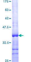 ab162240 on a 12.5% SDS-PAGE stained with Coomassie Blue.