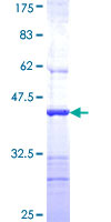 ab161120 on a 12.5% SDS-PAGE stained with Coomassie Blue.