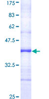 ab162281 on a 12.5% SDS-PAGE stained with Coomassie Blue.