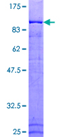 ab162549 on a 12.5% SDS-PAGE stained with Coomassie Blue.