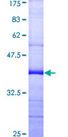 ab160244 on a 12.5% SDS-PAGE stained with Coomassie Blue.