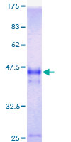 ab160354 on a 12.5% SDS-PAGE stained with Coomassie Blue.