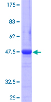 ab160355 on a 12.5% SDS-PAGE stained with Coomassie Blue.
