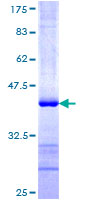 ab163838 on a 12.5% SDS-PAGE stained with Coomassie Blue.