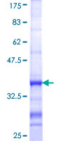 ab153097 on a 12.5% SDS-PAGE stained with Coomassie Blue.