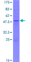 ab165294 on a 12.5% SDS-PAGE stained with Coomassie Blue.