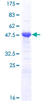 ab161207 on a 12.5% SDS-PAGE stained with Coomassie Blue.