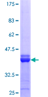 ab161208 on a 12.5% SDS-PAGE stained with Coomassie Blue.