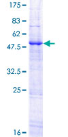 ab160558 on a 12.5% SDS-PAGE stained with Coomassie Blue.
