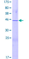 ab162154 on a 12.5% SDS-PAGE stained with Coomassie Blue.