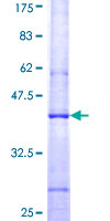ab162155 on a 12.5% SDS-PAGE stained with Coomassie Blue.