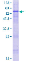 ab165460 on a 12.5% SDS-PAGE stained with Coomassie Blue.