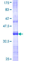 ab165861 on a 12.5% SDS-PAGE stained with Coomassie Blue.