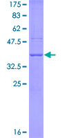 ab163725 on a 12.5% SDS-PAGE stained with Coomassie Blue.