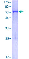 ab165112 on a 12.5% SDS-PAGE stained with Coomassie Blue.